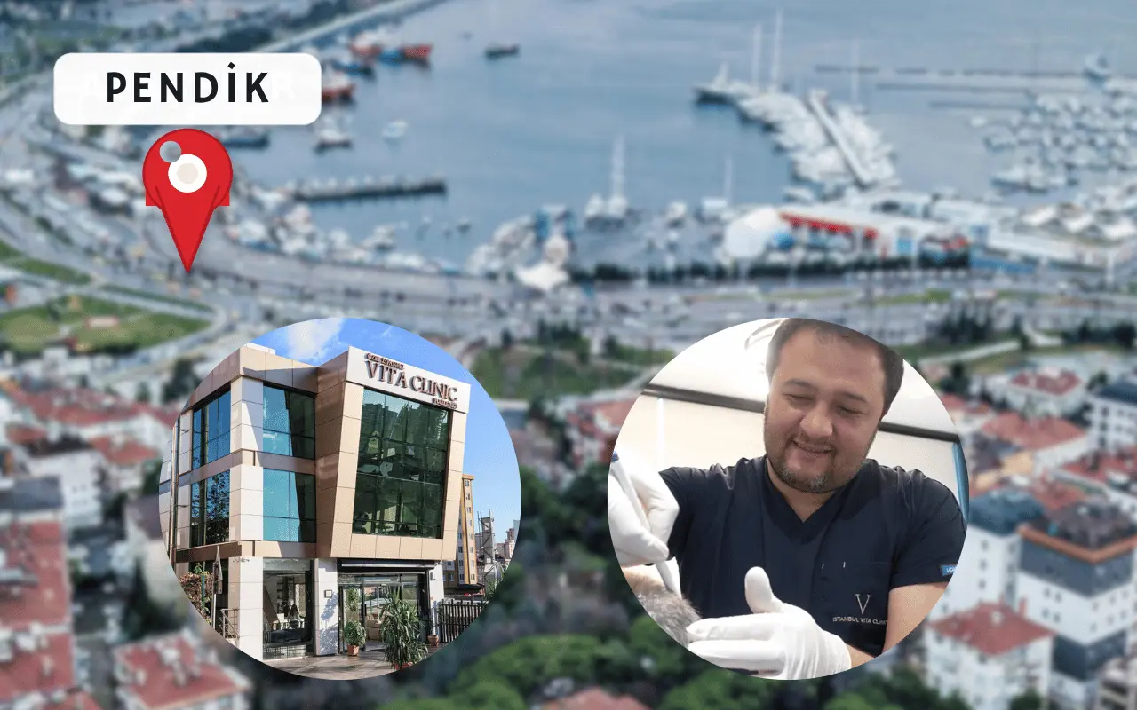 Pendik saç ekimi