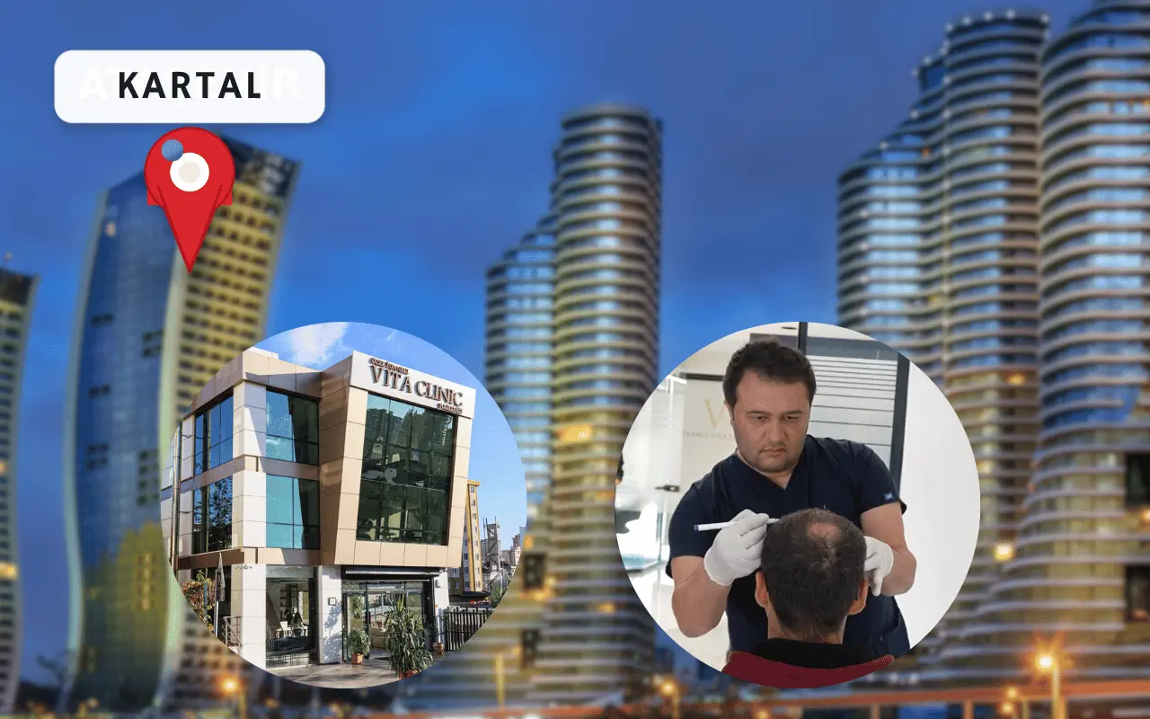 kartal saç ekim merkezi