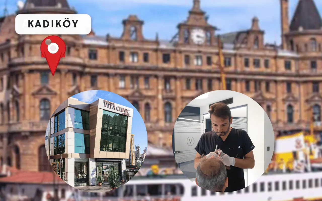 Kadıköy Saç Ekim Merkezi