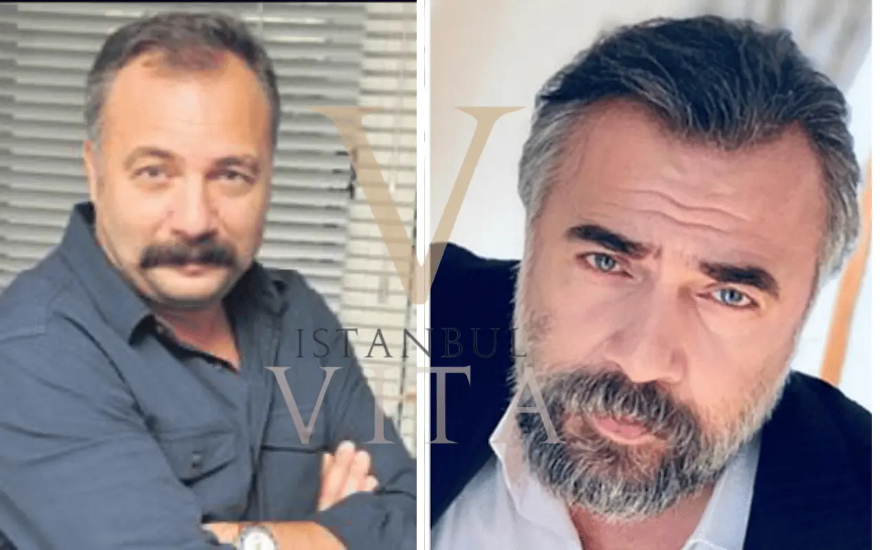 Oktay Kaynarca Saç Ekimi