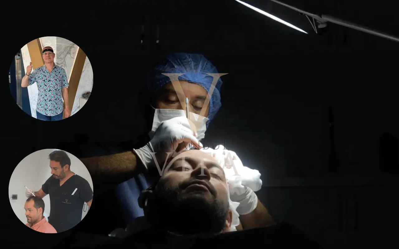 doctor is doing hair treansplant 