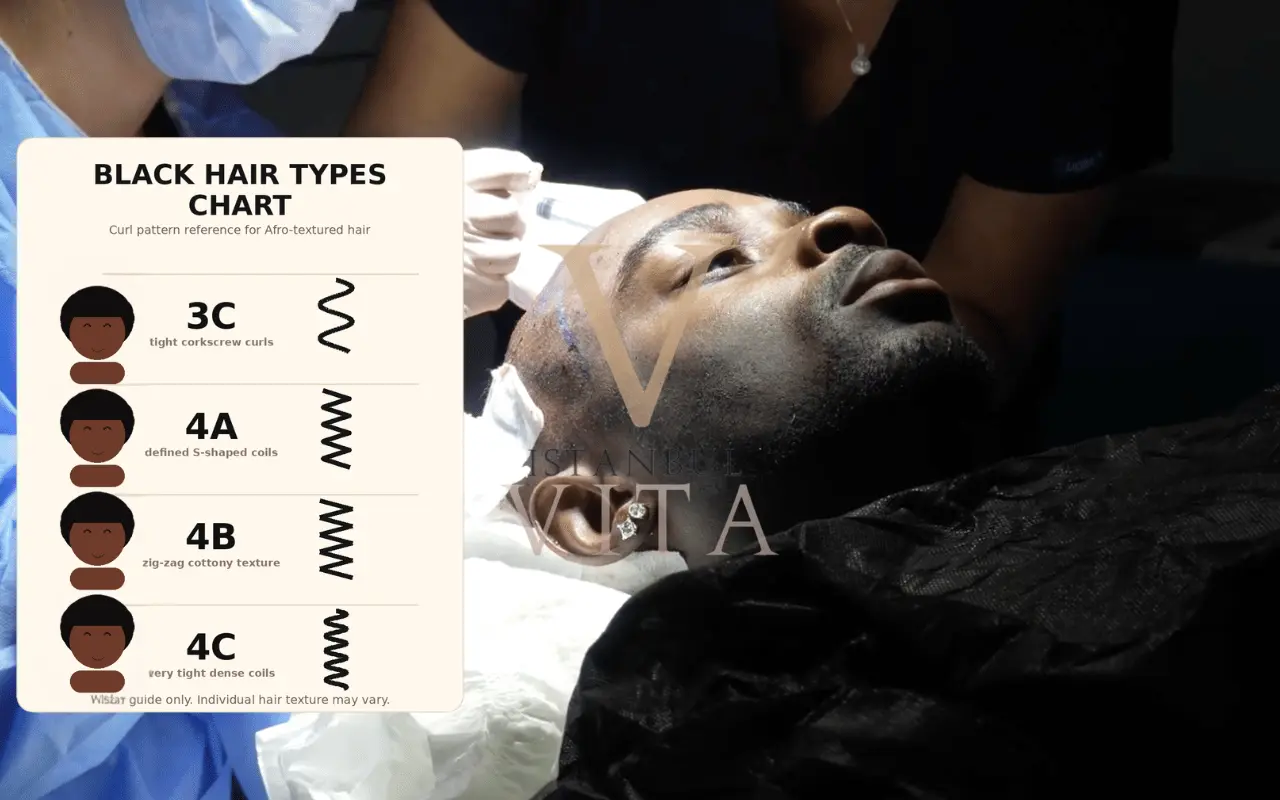 Type 4 Hair Transplant