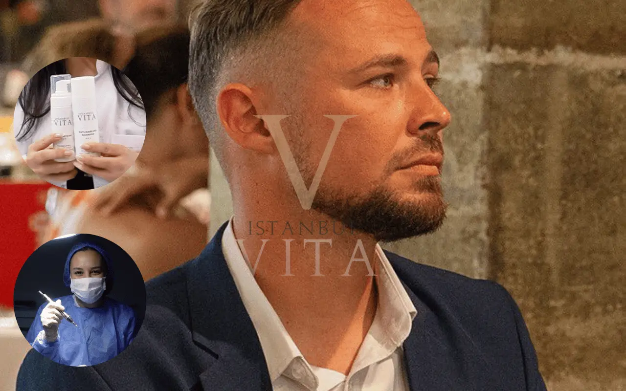 an after pic of hair transplant results