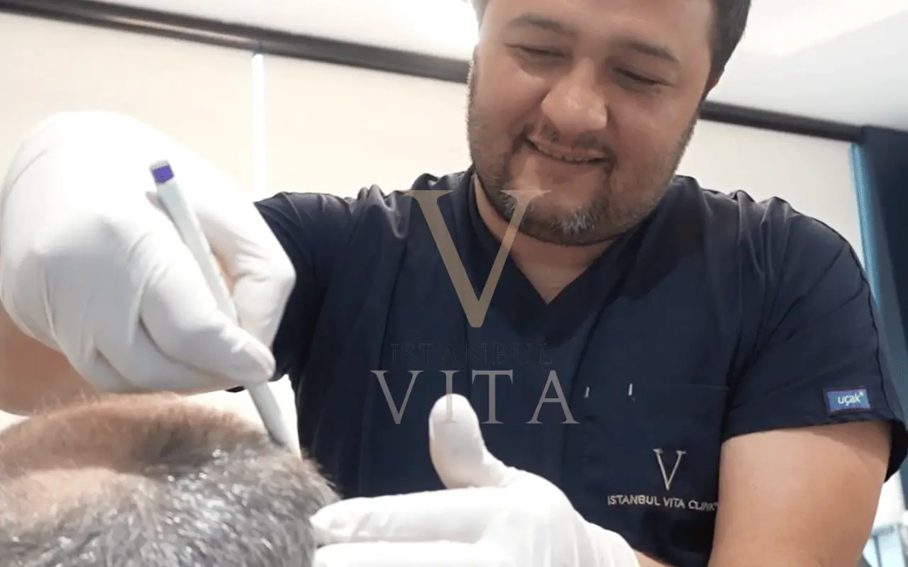 doctor is checking the patient hair for transplant