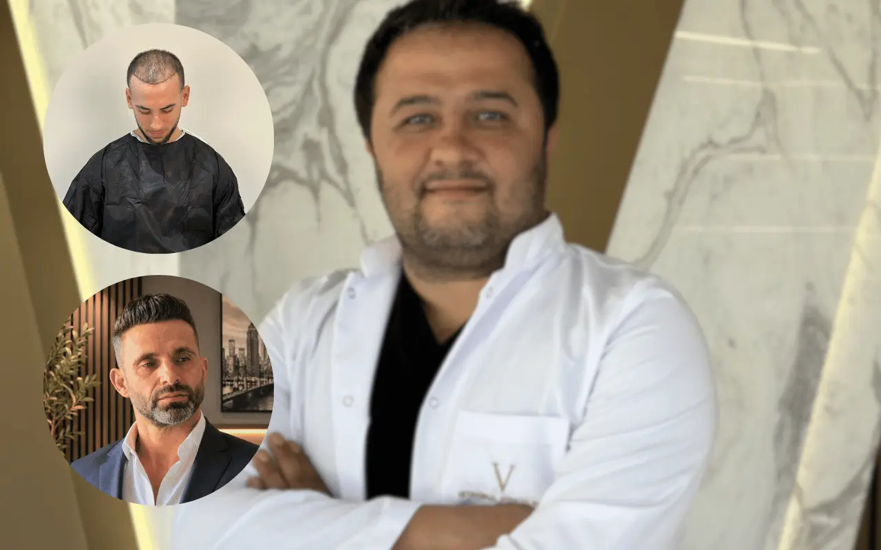 doctor and the patient's before and after hair transplant results 