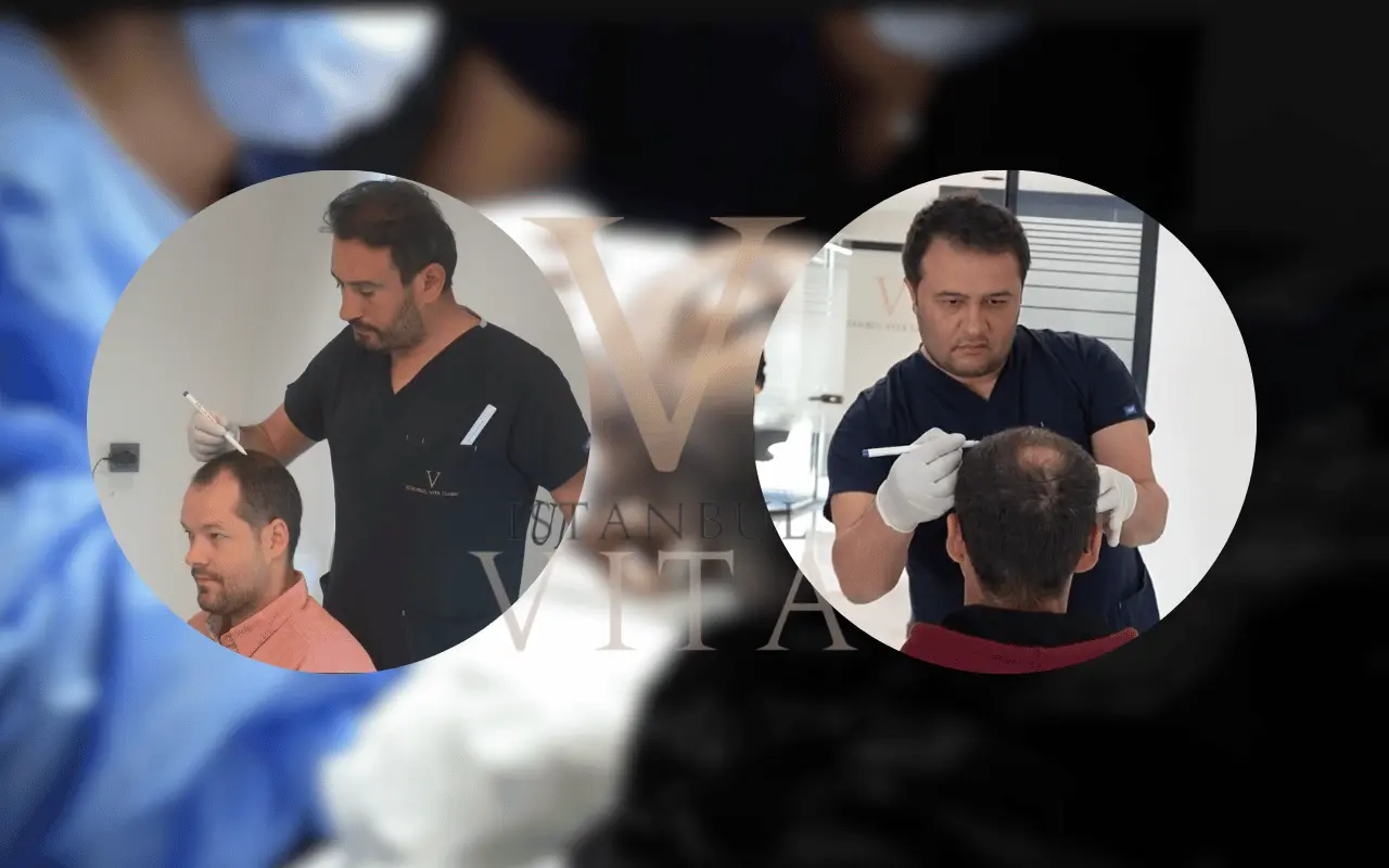doctors are checking before hair transplant procedure