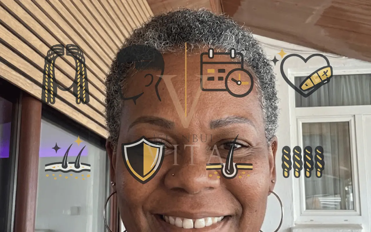 Protective Hairstyles After Afro Hair Transplant