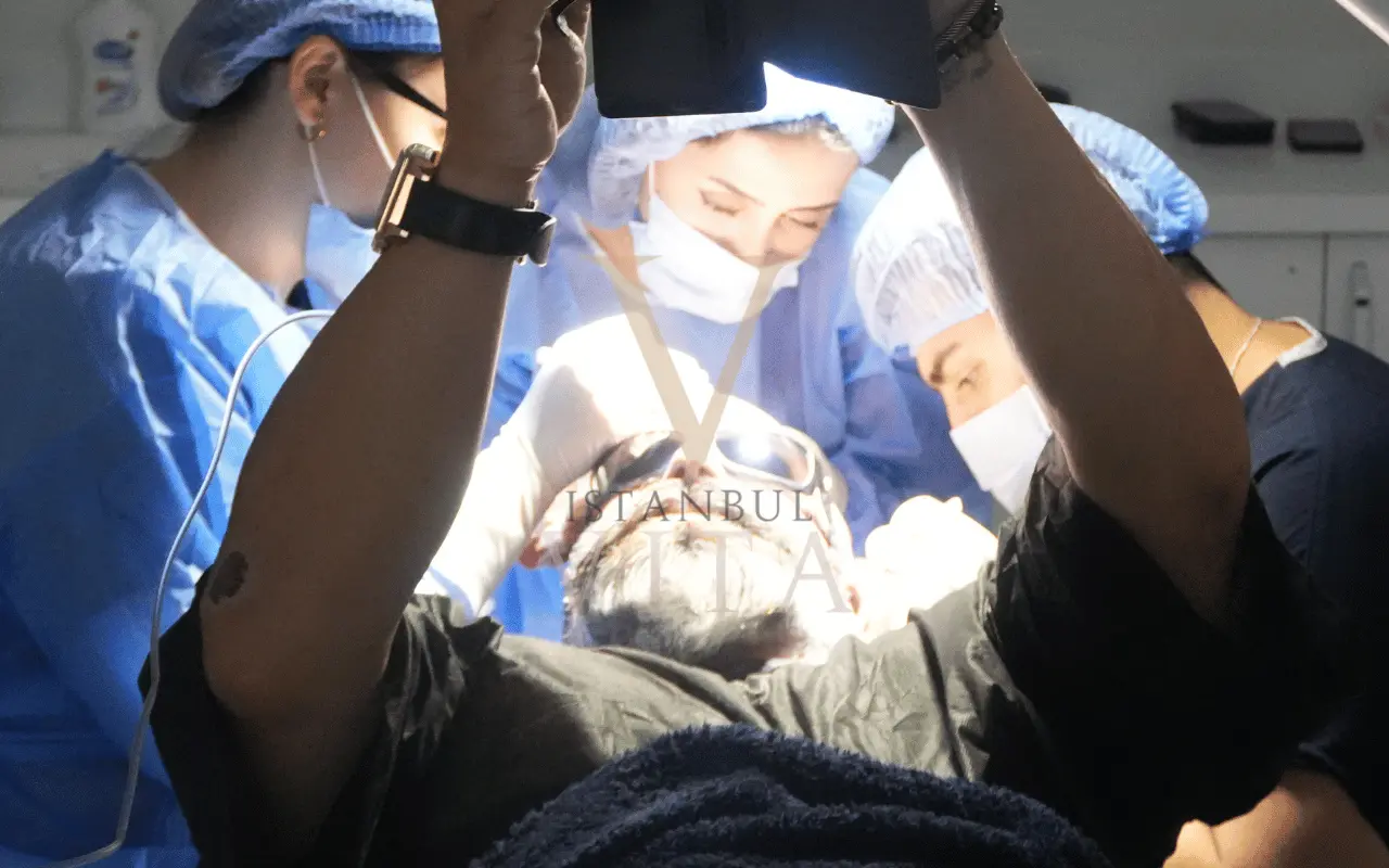 doctors doing hair transplant