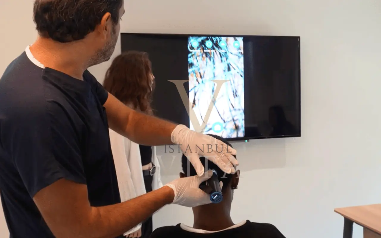 Afro Hair Transplant