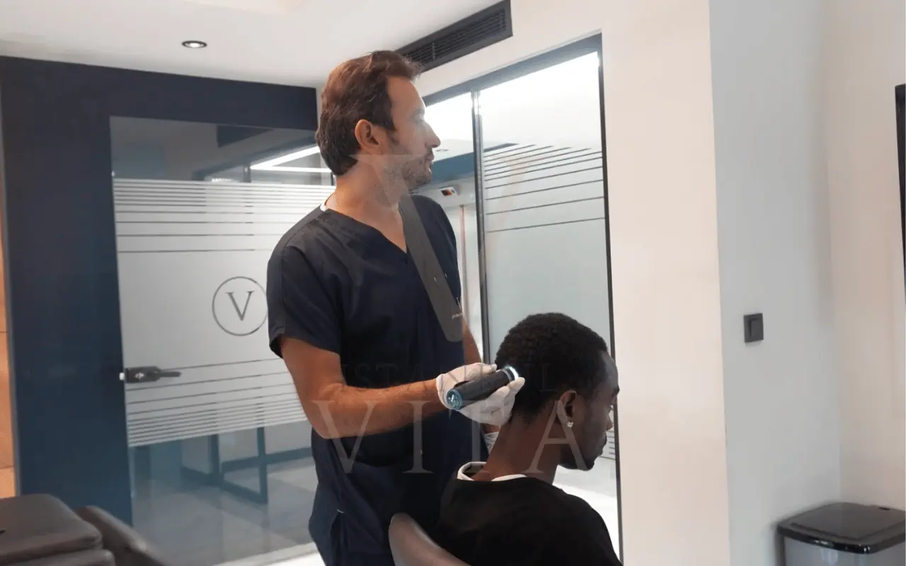 afro hair transplant process