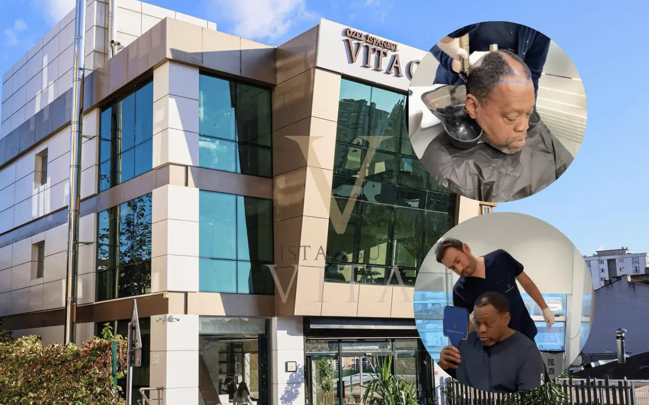 best afro hair transplant clinic