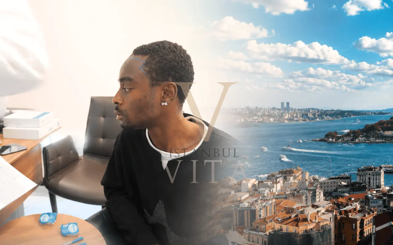 Afro hair transplant in İstanbul