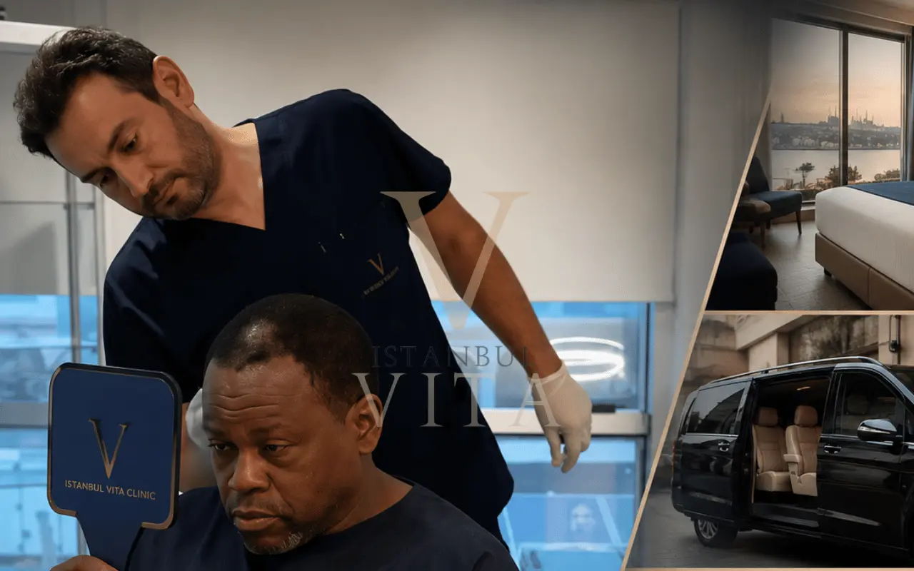 afro hair transplant Turkey package