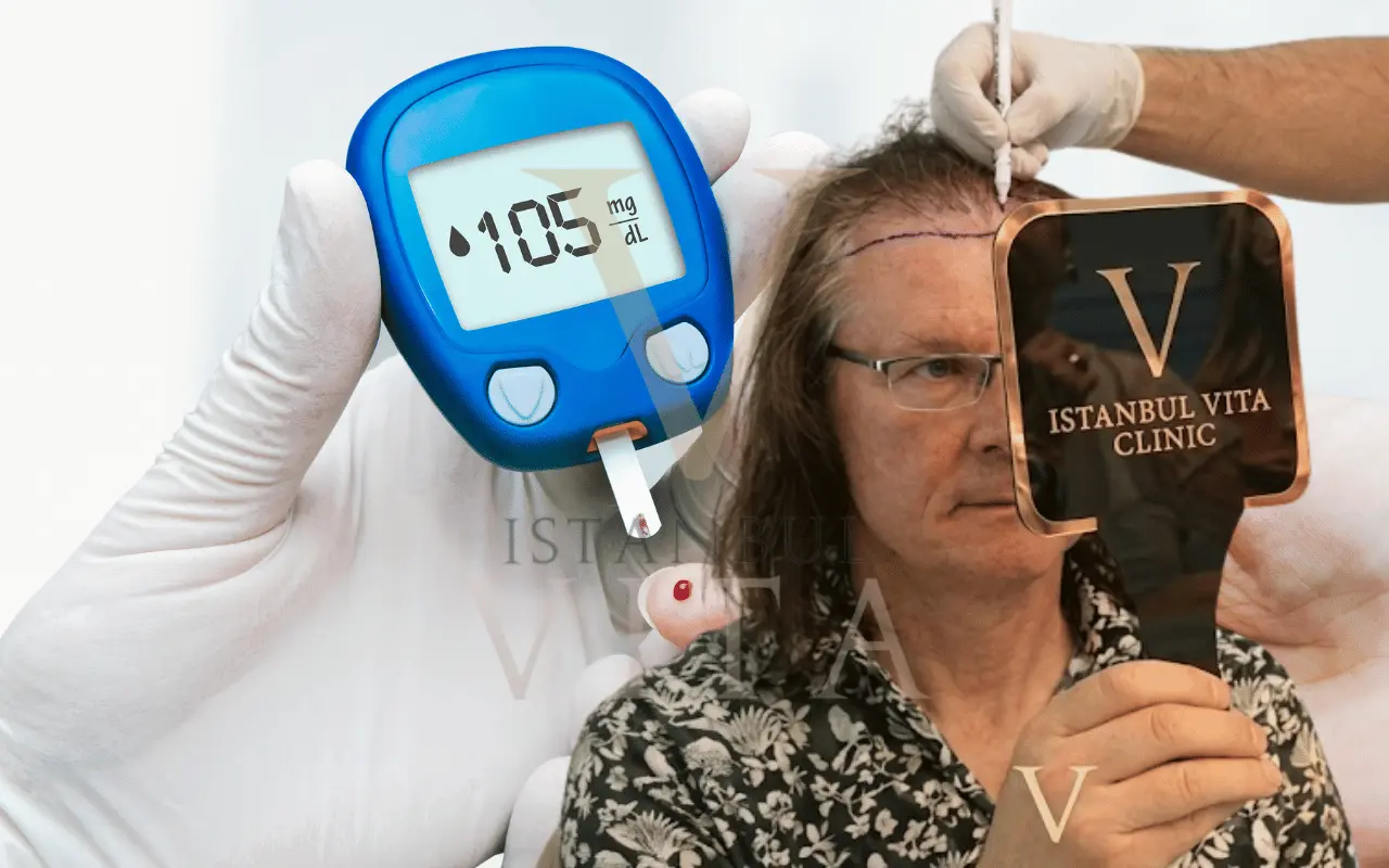 a diabetic patient before hair transplant surgery