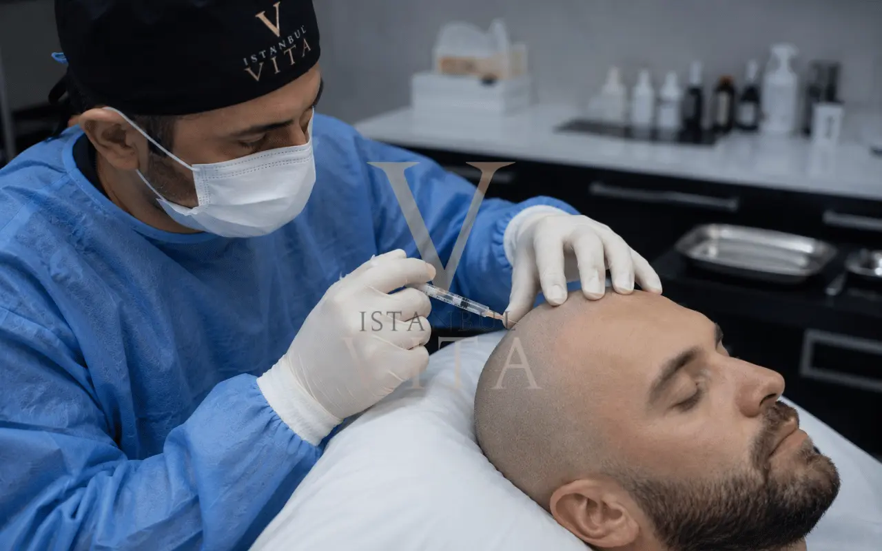local anesthesia after hair transplant 