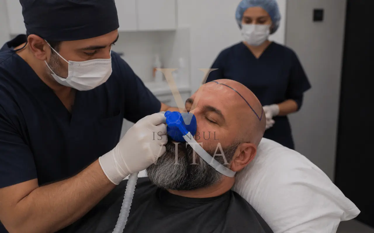 sedation during hair transplant 
