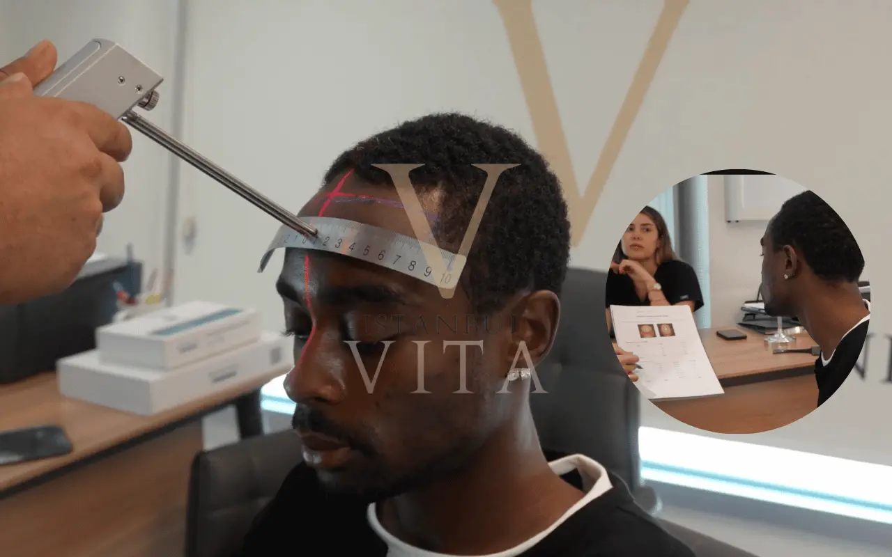 afro hair transplant consultation
