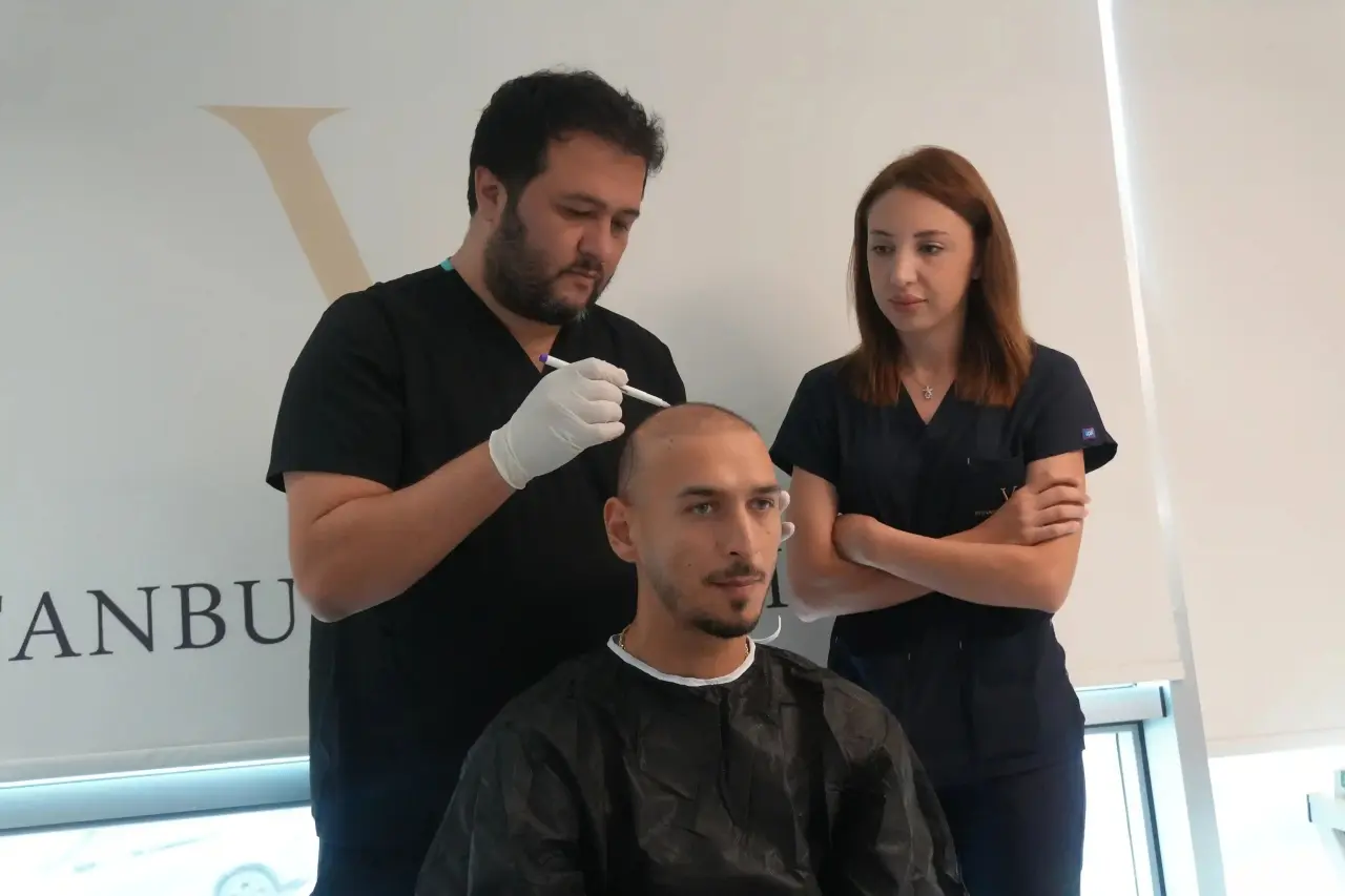 Doctor-led hair transplant consultation and treatment planning at Istanbul Vita