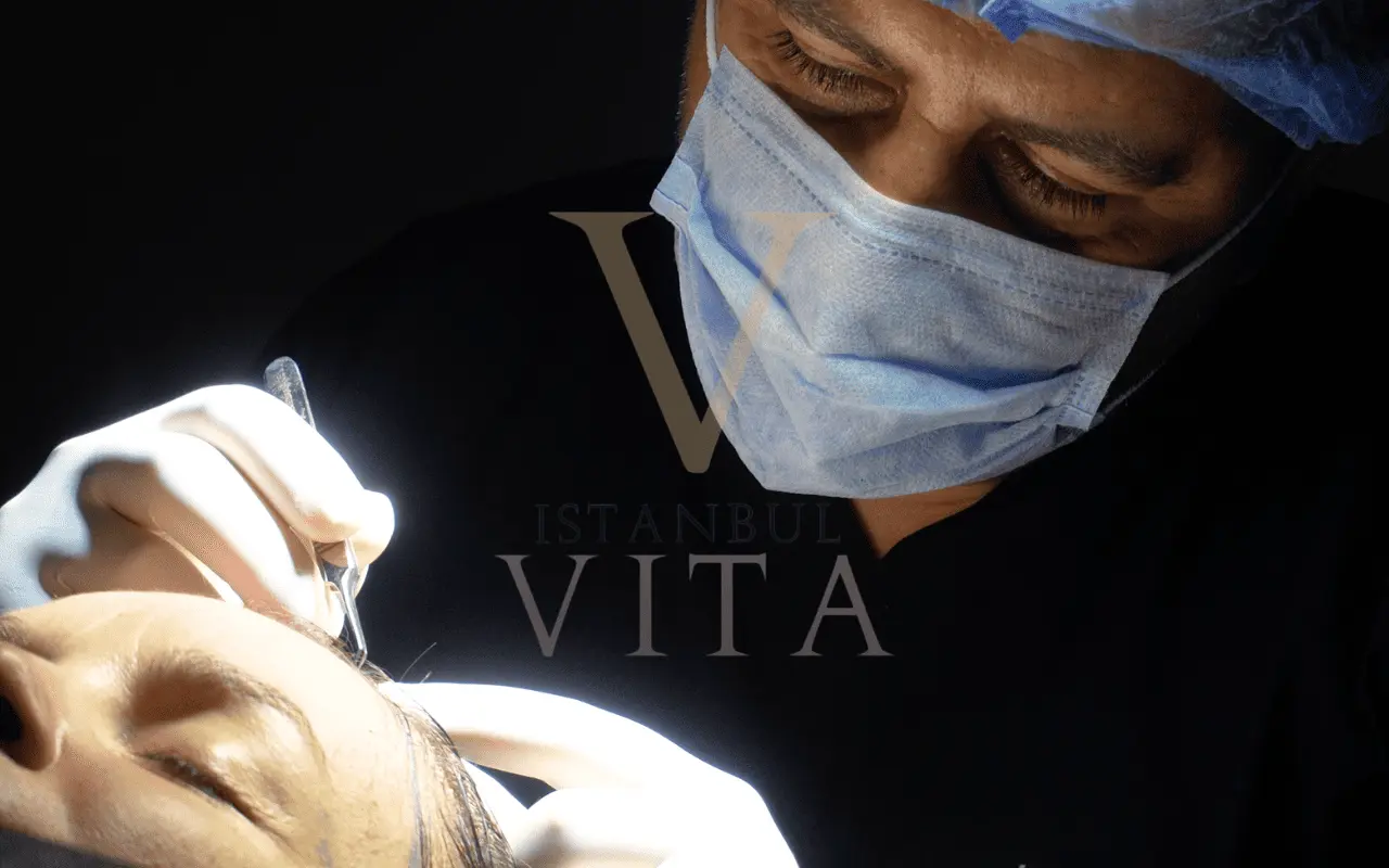 Hair transplant procedure at Istanbul Vita during graft placement