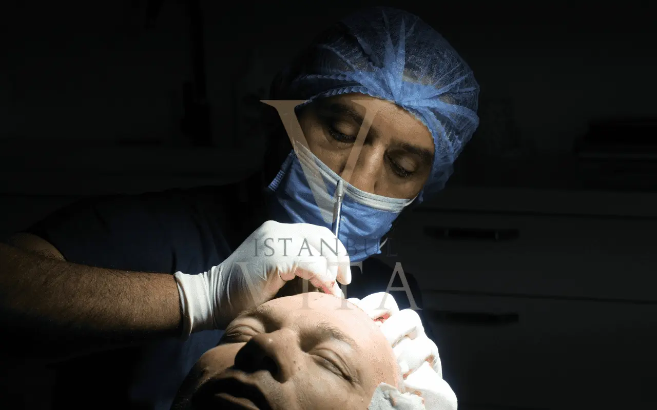 TDF hair transplant procedure during graft handling at Istanbul Vita