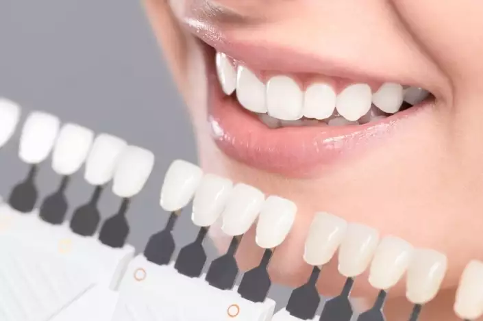 What to Expect After Dental Implant? Gummy Smile Cost?