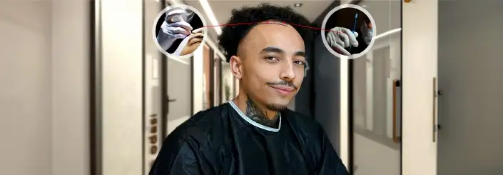 ▷ What is the Process of an Afro Hair Transplant | 2024 Cost