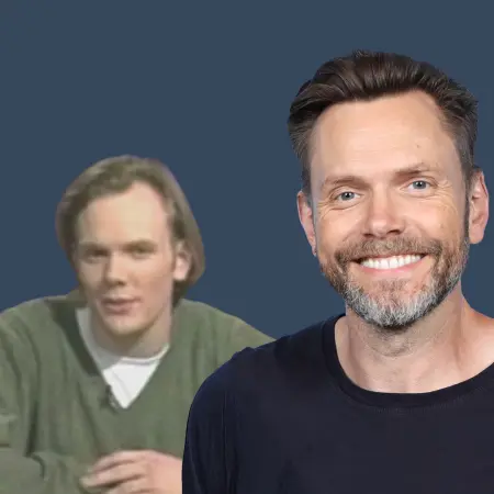 Joel McHale Before and After Hair Transplant
