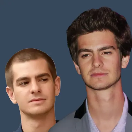 Andrew Garfield Before And After Hair Transplant