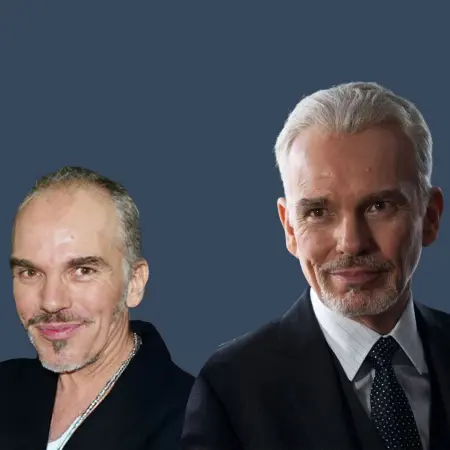 Billy Bob Thornton Before and After Hair Transplant