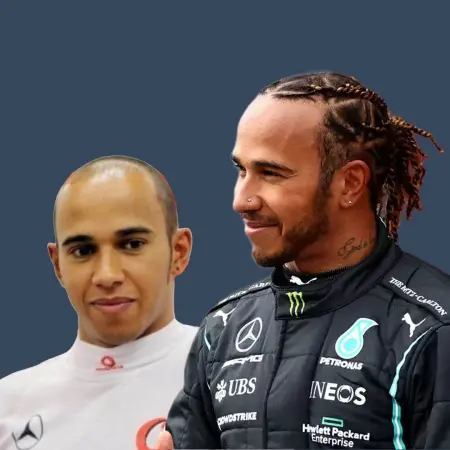 Lewis Hamilton Before and After Hair Transplant