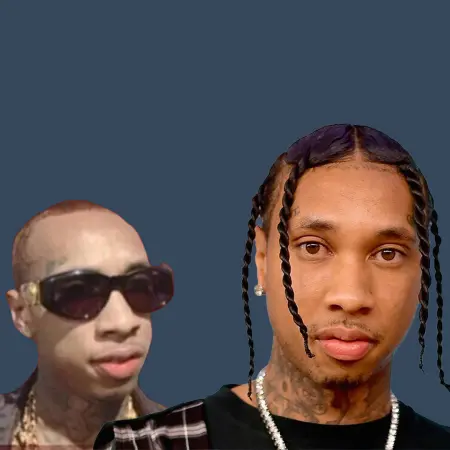 Tyga Before and After Hair Transplant Results
