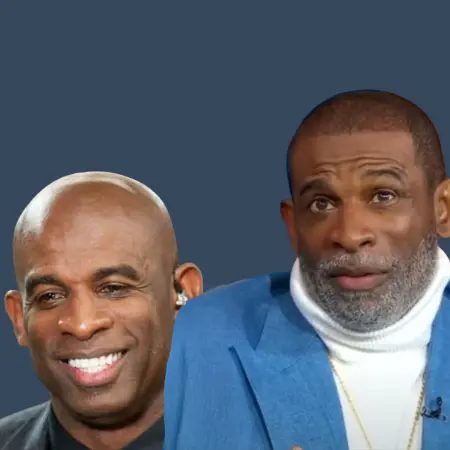 Deion Sanders Before and After Hair Transplant