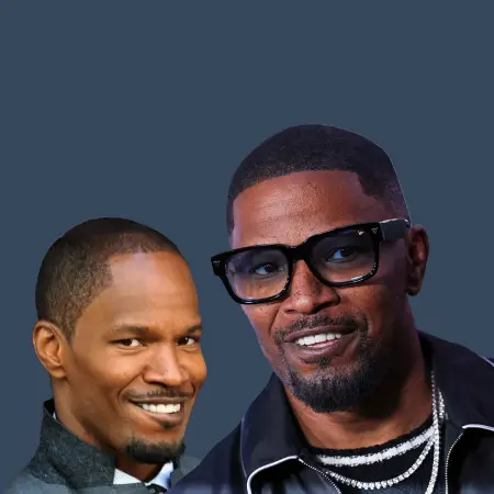 Jamie Foxx Before and After Hair Transplant