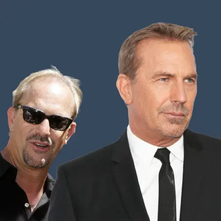 Kevin Costner Before and After Hair Transplant 