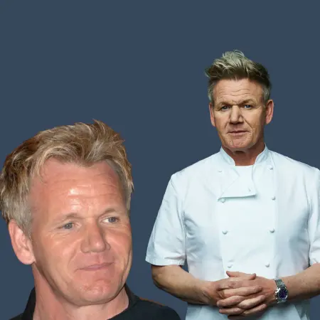 Gordon Ramsay Before and After Hair Transplant