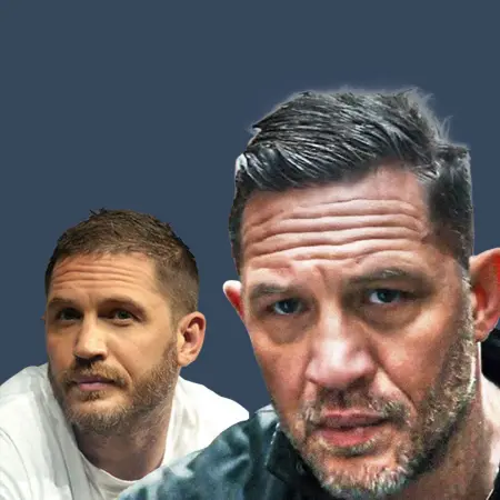 Tom Hardy Before and After Hair Transplant