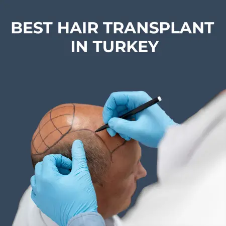 Best Hair Transplant Clinic in Turkey Istanbul Price