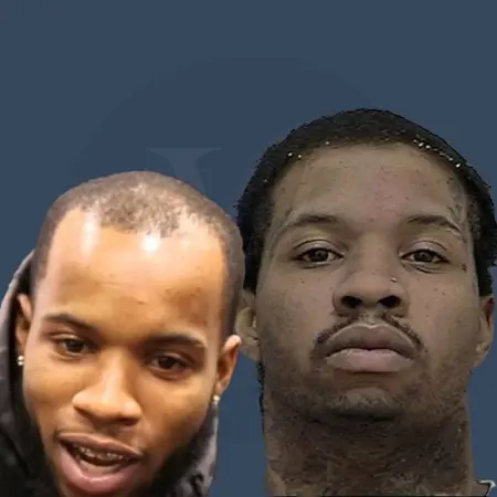 Tory Lanez Before And After Hair Transplant Results