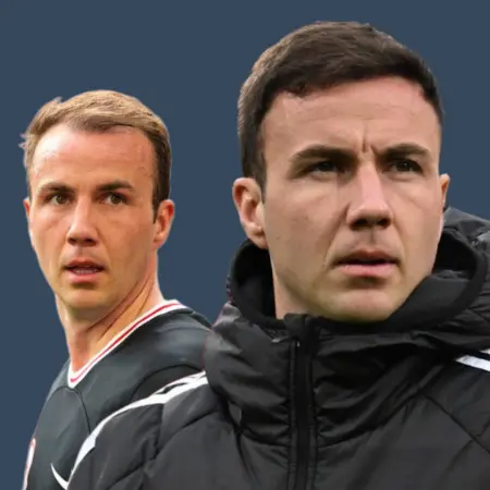 Mario Götze Haartransplantation: Vorher und Nachher