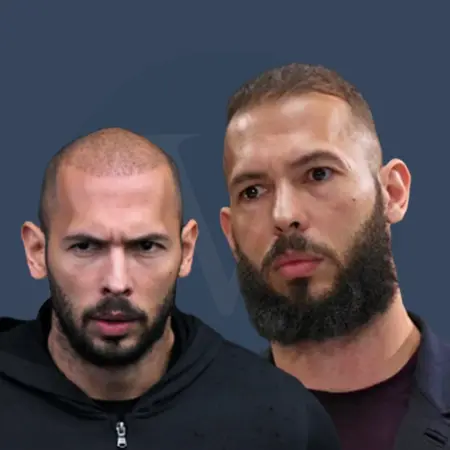 Andrew Tate Before and After Hair Transplant