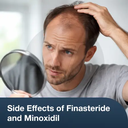Finasteride and Minoxidil: Hair Growth & Side Effects