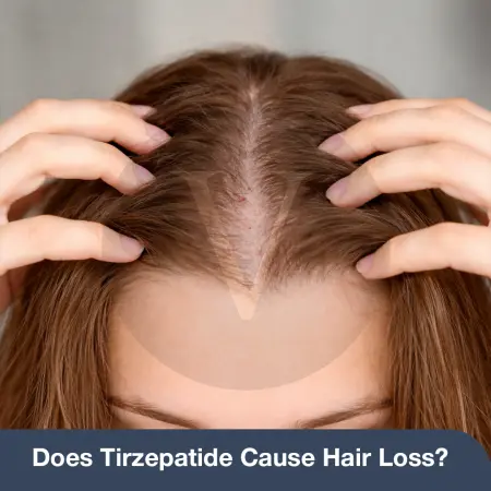 Does Tirzepatide Cause Hair Loss? Side Effects & Treatment