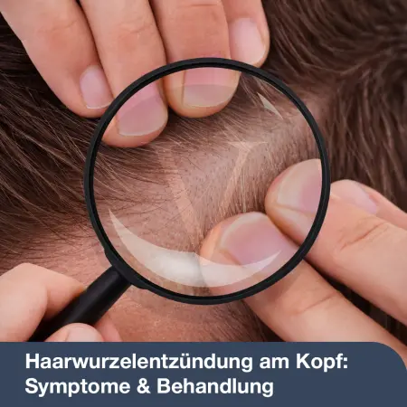 Haarwurzelentzündung am Kopf: Symptome & Behandlung