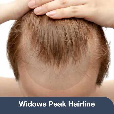 Widows Peak Hair: Styles, Fixes & Hairline Differences