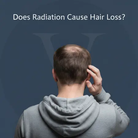Does Radiation Cause Hair Loss? Therapy & Chemo Explained