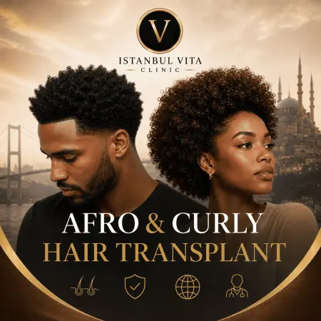 Curly Hair Transplant Turkey: Complete Patient Guide