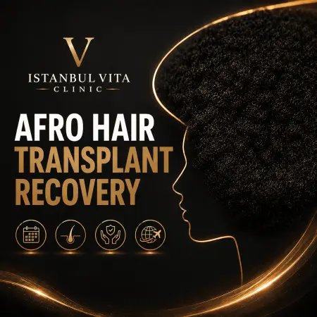 Afro Hair Transplant Recovery Guide  