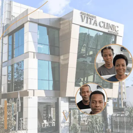Best Afro Hair Transplant Clinic: What Criteria Matter?