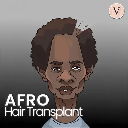 Afro Hair Transplant in Turkey 2026: Cost, Process & Results