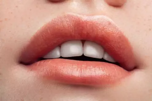 What is a Lip Lift & Lip Botox? Lip Surgery Costs in 2022?